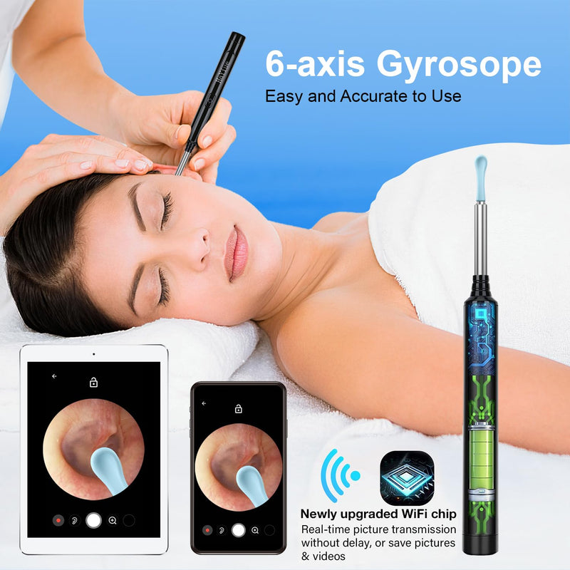 Ear Wax Removal with Camera, Earwax Remover Tool, 1296P FHD Wireless Ear Otoscope with 6 LED Lights, 6 Ear Spoon & 6 Traditional Tools Ear Wax Removal Kit for iPhone, iPad & Android Smart Phone - BeesActive Australia