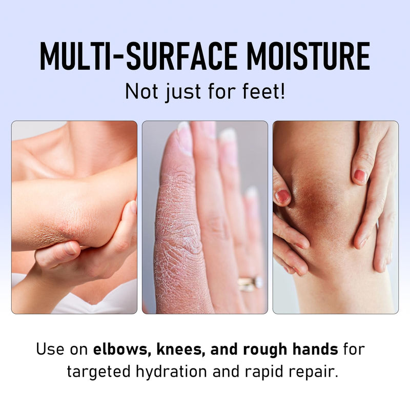 2Pcs Crack Feet Prevention Stick, Moisturizing and Hydrating Foot and Hand Balm, Remove Dead Skin Softening and Nourishing Anti-Cracking Foot Cream for Feet Elbows Knees 2pcs