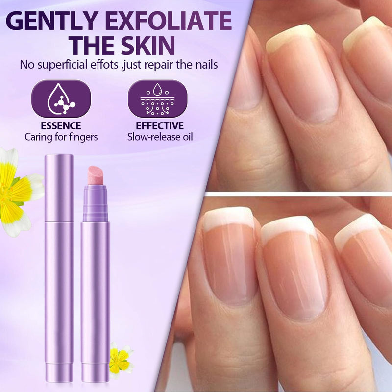 5Pcs Ceramic Cuticle Oil Pusher Pen, 2-in-1 Ceramic Cuticle Pushers Pusher & Oil Pen, Nail Care Pens for Manicure & Pedicure, Hangnails, Dry & Damaged Nails (Purple) Purple - BeesActive Australia
