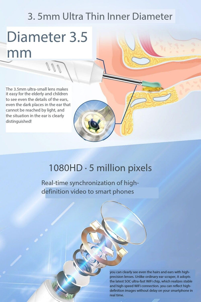Ear Wax Removal, 1080P FHD Wireless Otoscope Earwax Removal Tool, WiFi Ear Endoscope with LED Lights, 3mm Mini Visual Ear Inspection Camera Silicone Ear Pick for Adults Kids Pets (White) - BeesActive Australia