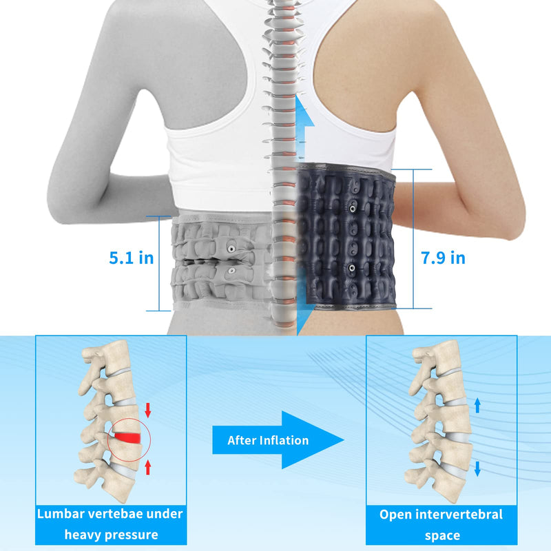 Decompression Back Belt - Lumbar Support Belt for Men & Women Lower Back Pain Relief, Back Traction Device Fits Waist Size 29-49 Inches (Blue) Blue - BeesActive Australia