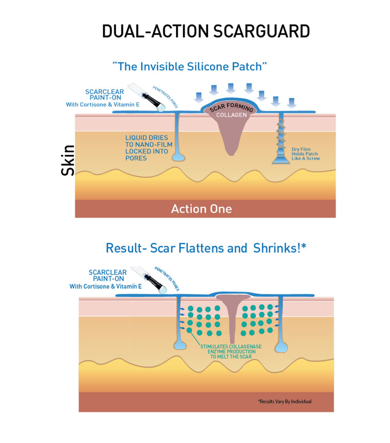 Scarguard - Invisible Brush-On Silicone Sheet with Vitamin E - Scar Removal for Keloids, Burn Scars, Surgery Scars, Stitches, Cuts - No Ugly Scar Sheets, Cream or Messy Scar Gel Needed - BeesActive Australia