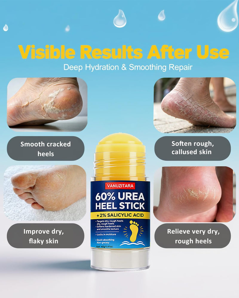 Urea Cream 60 Percent with 2% Salicylic Acid, Maximum Strength Foot Cream for Rough, Dry Cracked Feet Hands and Elbows, Urea Stick Callus Remover Skin Softener Hydrating Balm 2 Pack (1.41oz Each) 1.41 Ounce (Pack of 2)