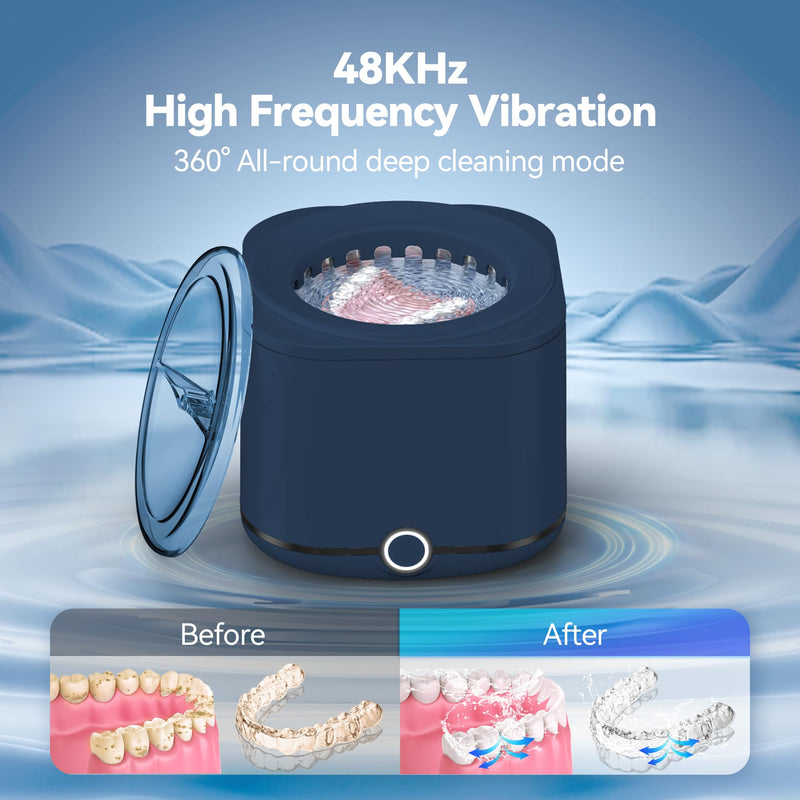 Miorcols Retainer Cleaner, 48kHz Ultrasonic Retainer Cleaner Machine for Denture, Mouthguard, Braces, Night Guard, Aligner, Toothbrush, Jewelry with 7.8OZ Dental Cleaning Pod-Blue