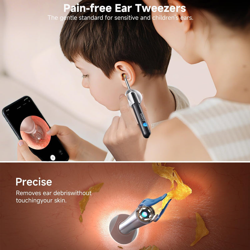 BEBIRD R1 Ultra Ear Wax Removal, Ear Cleaner with Camera Ear Scope, Wax Remove Ear Pick with Ear Otoscope Tweezers, Visual Dropper Cleaning Kit, Ear/Nose/Throat Examination Tool for Family Black - BeesActive Australia