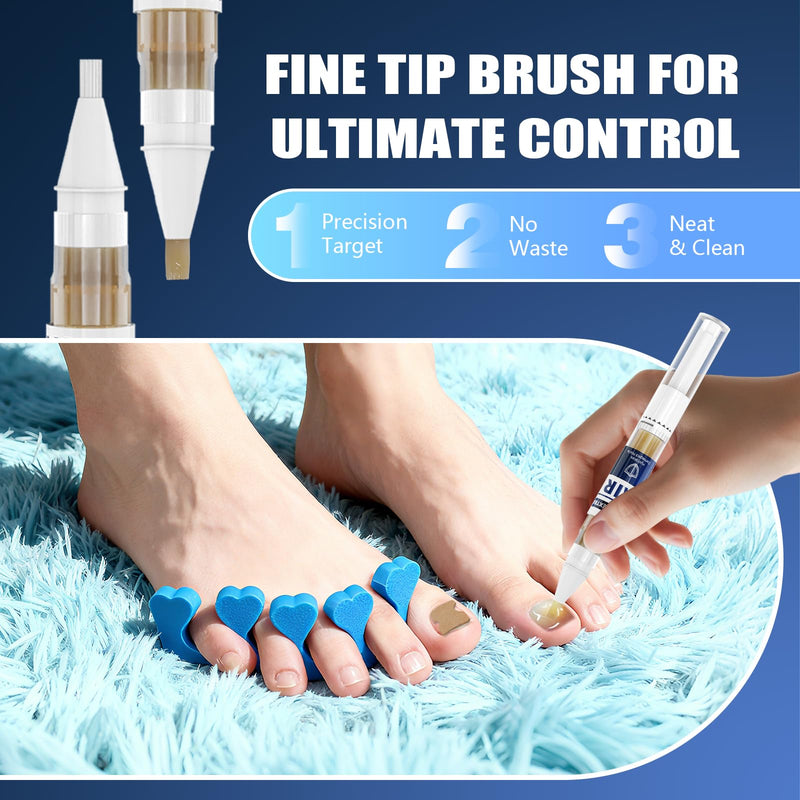 Toenail Fungus Pen – 25% Undecylenic Acid, Toenail Fungus Treatment Extra Strength, Nail Fungus Treatment Pen for Toenail & Finger, 5 x 3ml, Complete Care Kit with Nail Tools