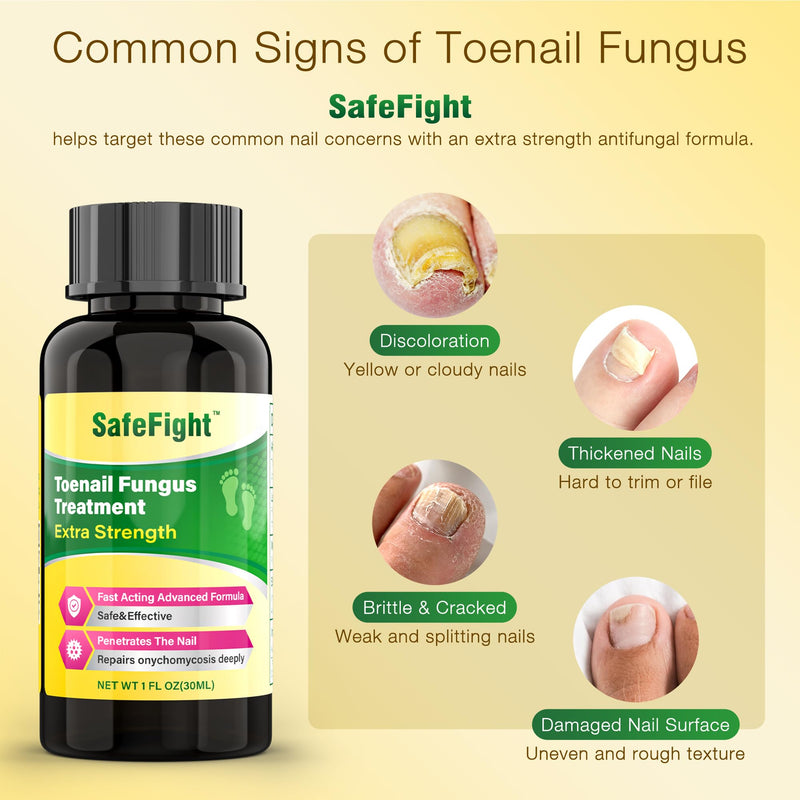 Toenail Fungus Treatment with 25% Undecylenic Acid & Tolnaftate - SafeFight Nail Repair Solution for Fungi Nail, Toenail Fungus Treatment Extra Strength Nail Repair for Fungi Nail 30ml - BeesActive Australia
