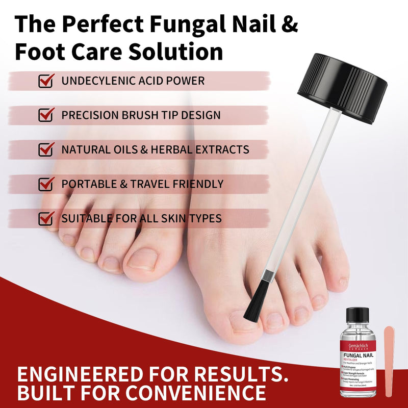 Toenail Fungus Treatment Extra Strength, Nail Fungus Treatment with Undecylenic Acid for Toenail & Fingernails, Antifungal Nail Repair for Athletes Foot, Ingrown, Thick, Broken, Damaged Nail, 30ml 1 Fl Oz (Pack of 1)