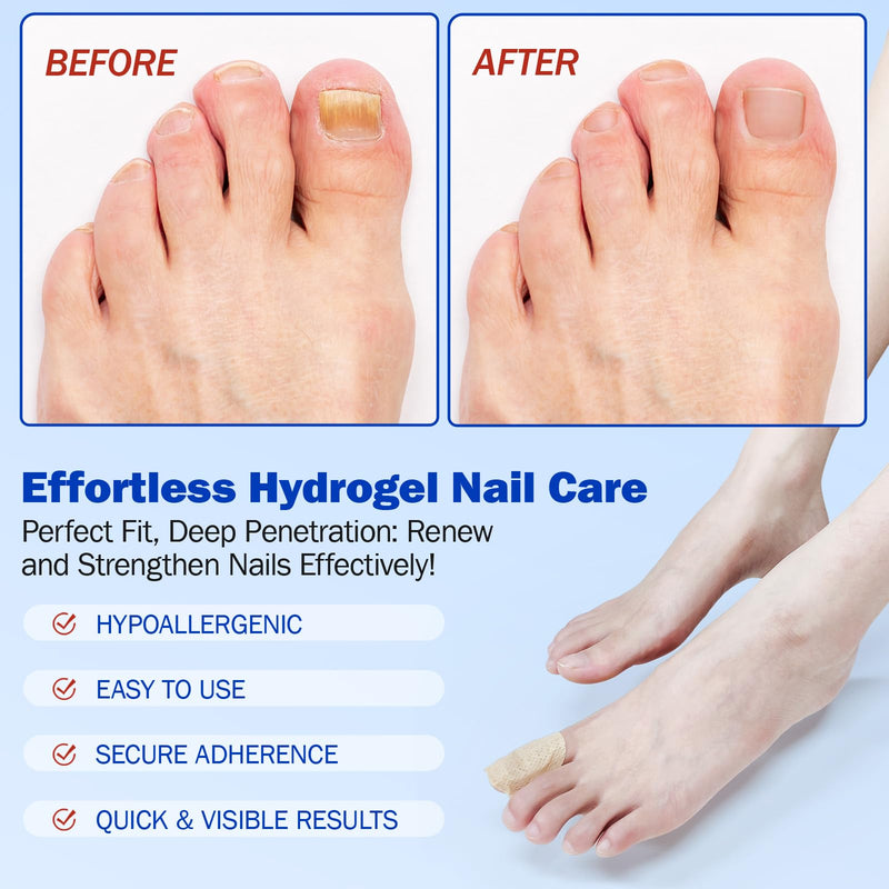 Nail Patches for Toenail Repair – 42PCS Overnight Nail Support for Damaged, Thick, or Yellow Toenails, Natural Formula, 8-Hour Renewal Patch for Men and Women, Safe for Daily Use 1 Count (Pack of 42)