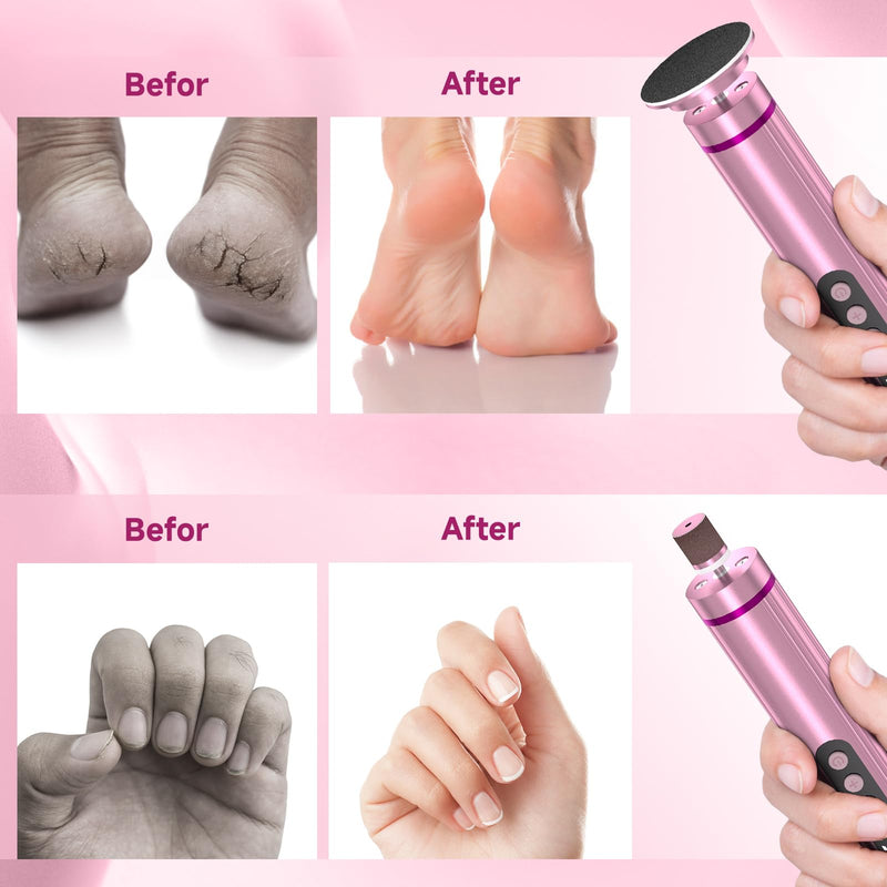 Electric Foot Nail File Cordless, 2 in 1 Wireless Dermave Electric Foot Callus Remover, Adjustable 9 Speed Rechargeable Pedicure Foot Filer Tool w/Sandpaper Discs & Nail Drill Bits,Digital Display Pink - BeesActive Australia