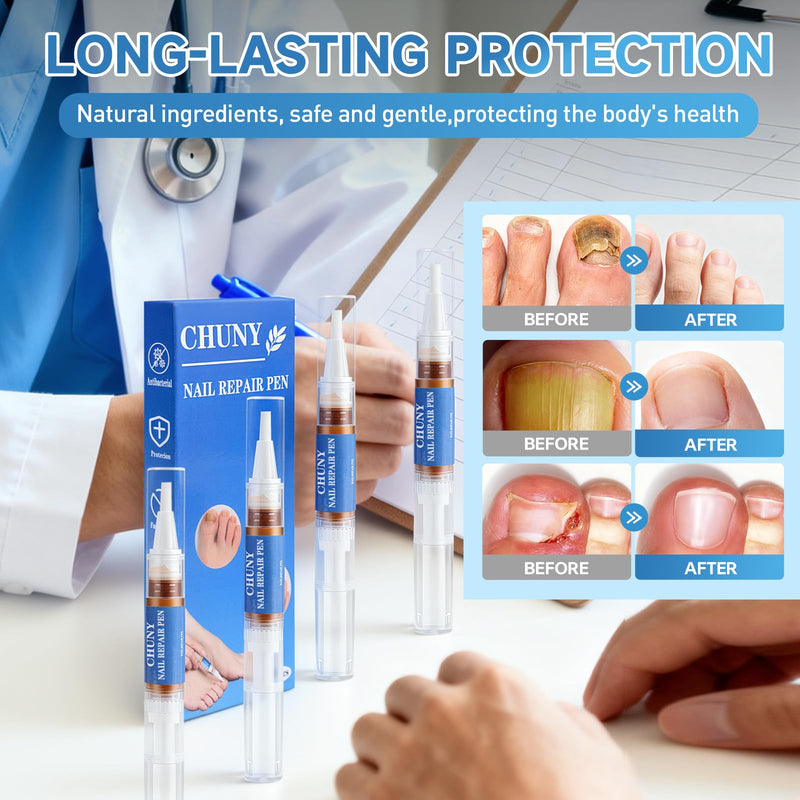 Extra Strength Nail Repair Pen, 4 Nail Oil Cuticle Pens With Natural Plant Extracts for Repairing Discolored, Broken & Damaged Toenails, Effective Nail Repair Solution - BeesActive Australia
