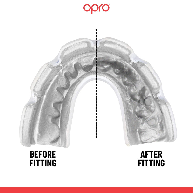 OPRO Braces Mouthguard – Custom-Fit, Slim & Breathable Design – Shock-Absorbing Sports Mouth Guard for Wrestling, Basketball, Football, MMA, Lacrosse, Hockey & More – Youth & Adult Clear/White