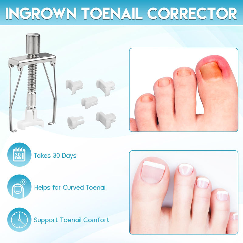 Ingrown Toenail Removal Kit, Professional Ingrown Toenail Tool Kit Includes Ingrown Toenail Corrector Drops, Corrector Patch, Toenail Clipper, Nail File Lifter Pedicure Tools - BeesActive Australia