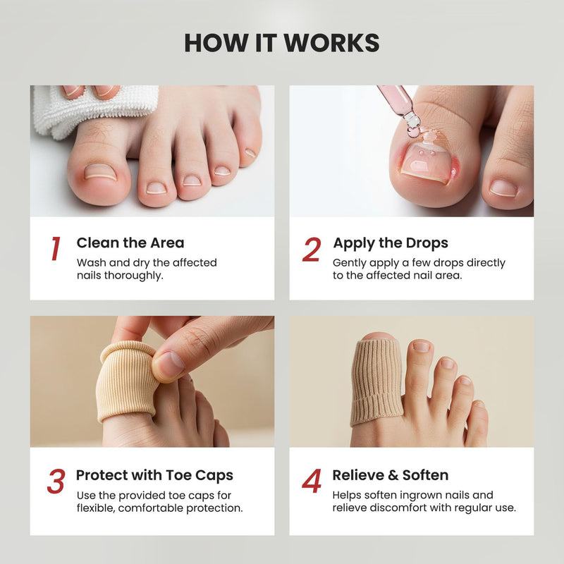 Treatonic Ingrown Toenail Treatment - Ingrown Toenail Pain Reliever and Softener Kit for Easy Trimming with Silicone Gel Toe Caps Ingrown Toenail Drops - BeesActive Australia