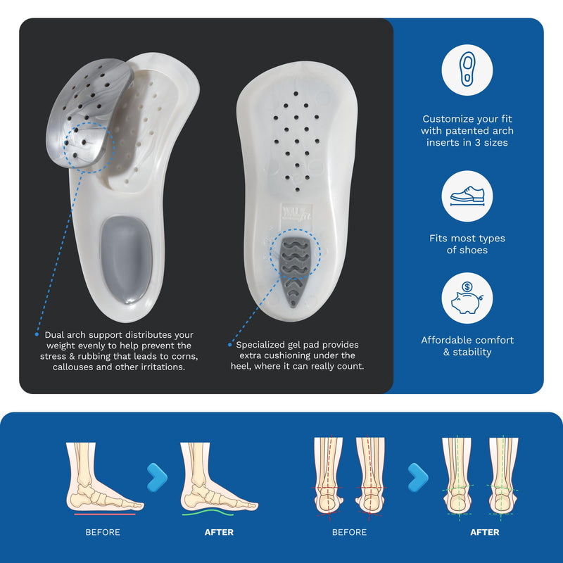 WalkFit Platinum Foot Orthotics Plantar Fasciitis Arch Support Insoles Relieve Foot Back Hip Leg and Knee Pain Improve Balance Alignment (Men 10-10.5 / Women 11-11.5) Men 10-10.5 / Women 11-11.5
