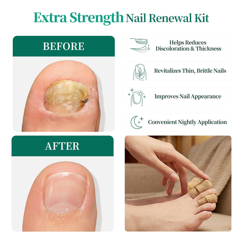 APUREE Fungal Nail Patches Extra Strength: True 1% Tolnaftate | 8H Overnight Fungal Toe Nail Treatments | FSA-HSA | Repair For Discolored Yellow Brittle Damage Nails| Revives Natural look| 64 Patch