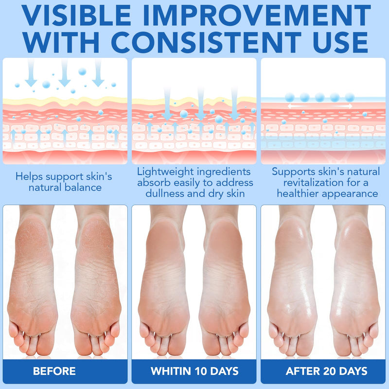 Urea Cream, Maximum Strength Urea Foot Cream, 60% Urea Cream Stick plus 2% Salicylic Acid Callus Remover for Dry Cracked Heels, Hands, Knees, Exfoliating Moisturizer, Dead Skin Remover Foot Balm 1.4OZ 1 Pack