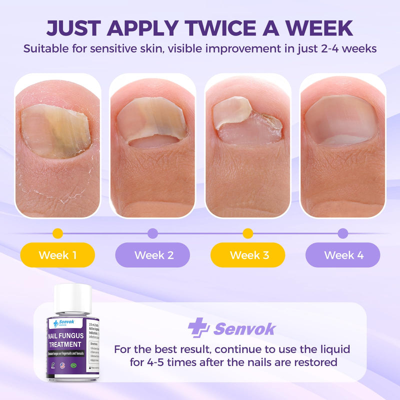 Toenail Treatment Extra Strength, Fast-Acting Toe Nail Treatments, Safety Restore and Renew Discolored & Damaged Nails, Improve Nail Health and Appearance 2.5 ML