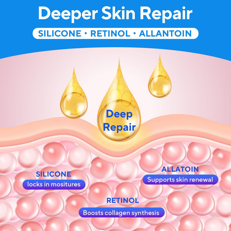Scar Cream, Silicone Scar Gel, Advanced Scar Removal Cream for Surgical Scars, Stretch Marks, Keloid Bump Removal, Injuries, Burns and Acne, Old and New Scars, Gentle on Sensitive Skin, 1.7 oz(50ml) - BeesActive Australia