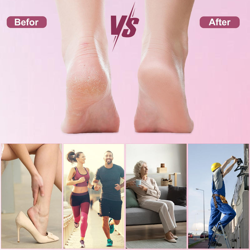Electric Foot Callus Remover – Foot Callus Remover for Feet with 60 Sandpaper Discs, Adjustable Speed Pedicure Tools for Dead Skin, Professional Electric Feet Callus Remover for Home Use - BeesActive Australia