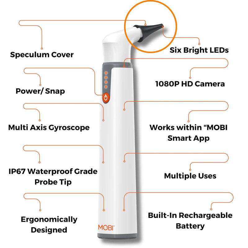 20-Piece Speculum Set for Use with MOBI Smart Bluetooth Otoscope - Professional Grade Accessories for Ear, Nose, and Throat Examination, Black - BeesActive Australia