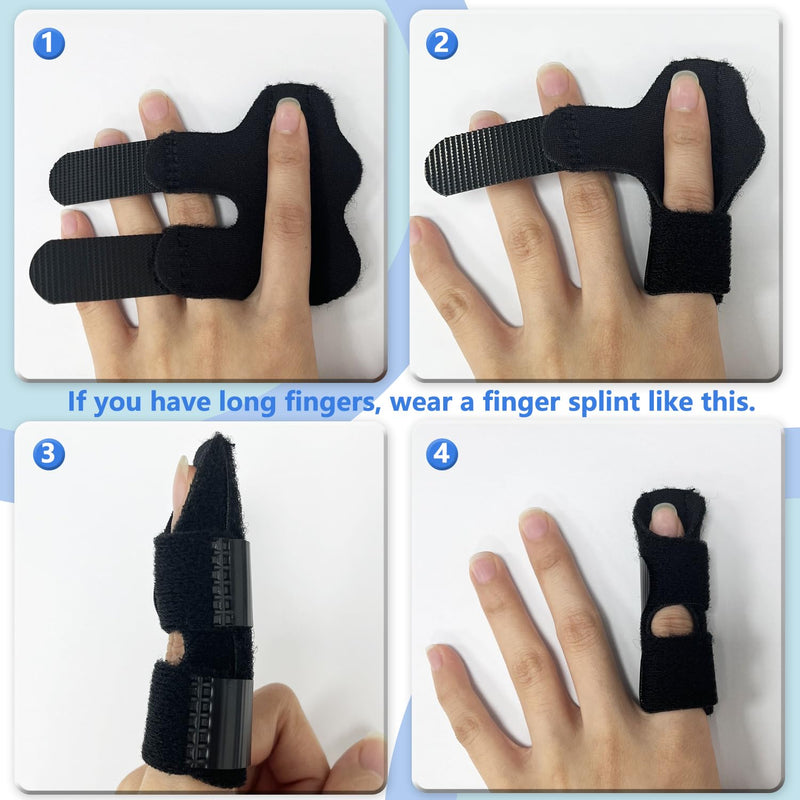 2 Pack Adjustable Trigger Finger Splints, Support for Arthritis, Tendonitis, and Hand Injuries – Ideal for Index, Middle, and Ring Fingers, Comfortable Night & Day Use - BeesActive Australia