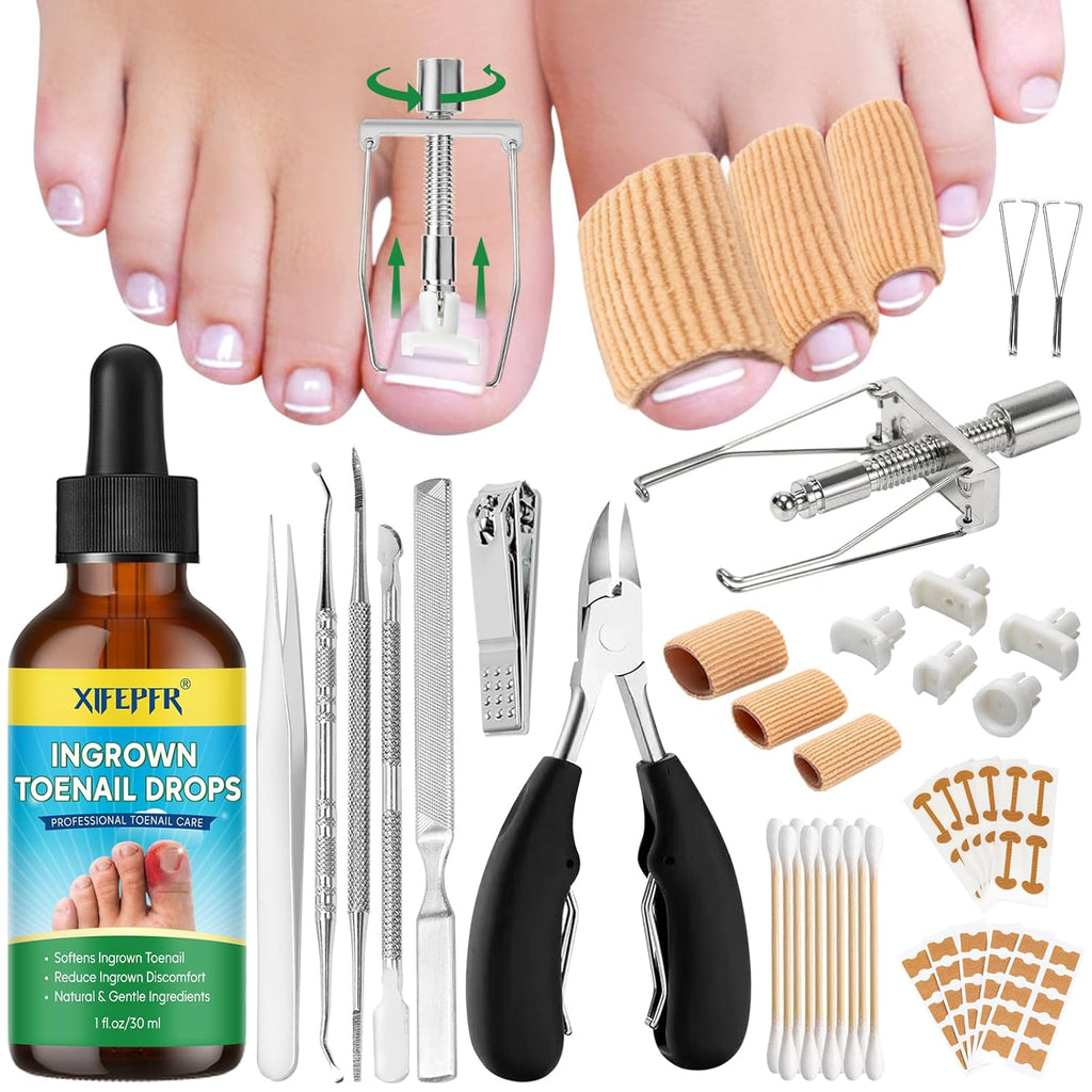 Dr. Krause Ingrown Toenail Treatment Kit Stainless Steel Pedicure Tools for Nail Correction, Softening and Easy Trimming, 1 Count Corrector & Retainers