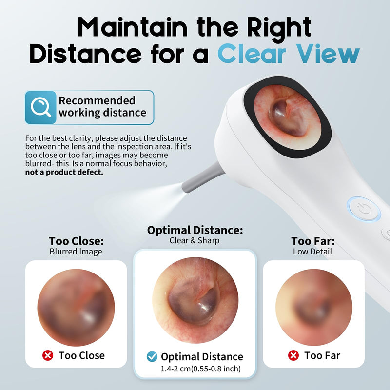 Otoscope Ear Camera with 1.21” Screen, 1080P Ear Scope with 4 LED Lights, Otoscope Camera for Adults Kids, Support Photo & Video, Type-C Charging with Computers, Baby Essentials, Home Medical Simplified – White - BeesActive Australia