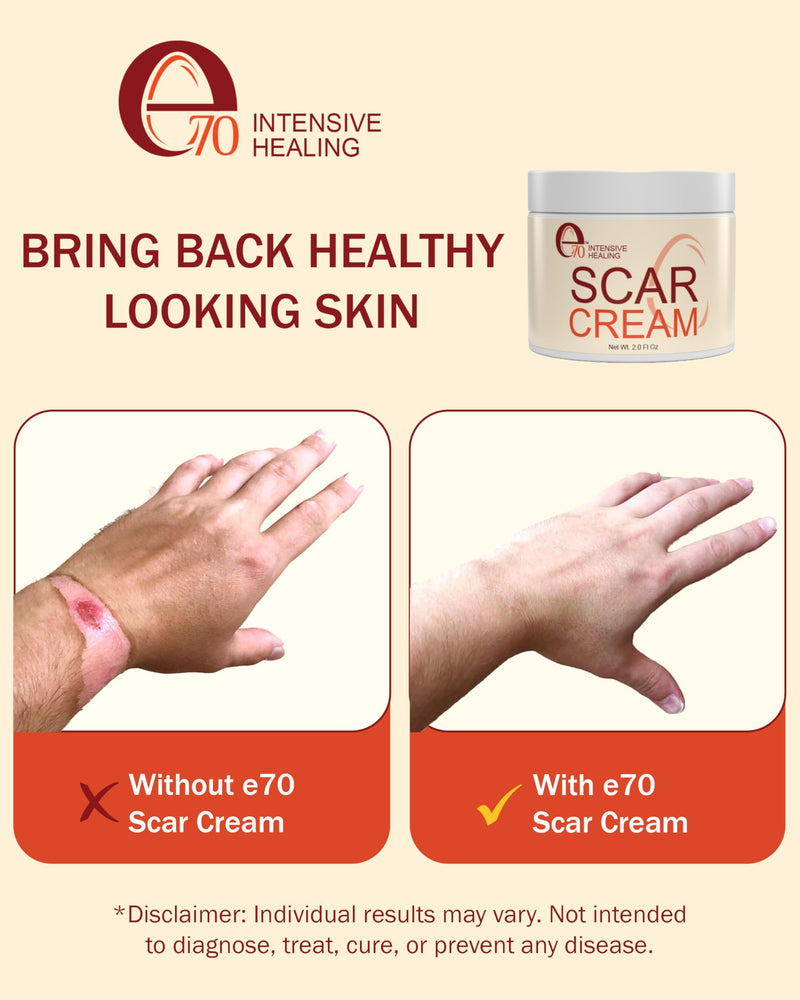 Scar Cream Gel for Surgical Scars Fast Repair C-Section -2.0 Fl Oz , Stretch Marks, Keloids, Burns, Scar Away Cream for Old Scars. Vitamins Full - All Skin Types - Reduce Acne Spots and scar treatment - BeesActive Australia