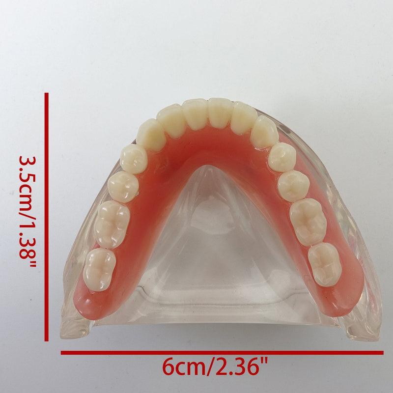 Dental Model Overdenture Inferior 2 Implants Demo for Studing and Teaching