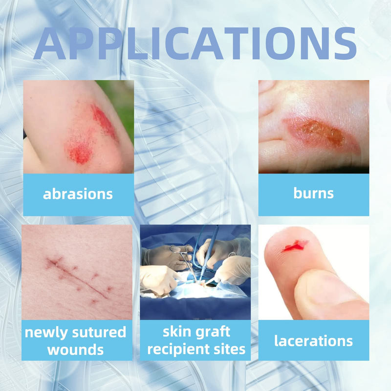 Dr.Med Xeroform Petrolatum Dressing Patch, 5"x9"-30 Pcs/Box, Non-Adherent Gauze Dressings, for Minor or Partial Thickness Burns, Lacerations, Skin Graft Recipient Sites, Newly Sutured Wounds 5"x9" (30 Pcs/Box) - BeesActive Australia