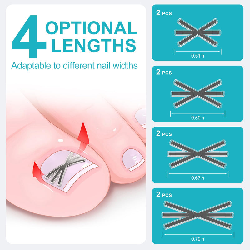 Ingrown Toenail Treatment Kit with Upgraded 6-Angle Shape,Titanium Alloy Ingrown Nail Corrector Tools with 4 Multi-Sizes,Ingrown Toe Nail Relief Remover Strips for Curved Toenail Quick Relief,8Pcs - BeesActive Australia