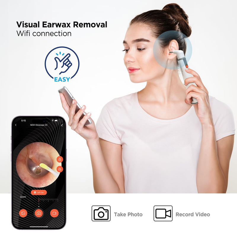 MOBI Otoscope Ear Cleaning Accessory Kit, Compatible with MOBI Smart Otoscope, Great for Earwax Removal. Includes 14 Pieces with Multi-Use Functionality - BeesActive Australia