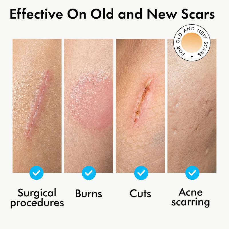 Serica Scar Gel (1oz), Advanced Silicone Formula, Supports Visibly Smoother-Looking Skin After Surgery, Cuts, Burns or Acne, Non-Comedogenic Face-Safe Gel, Helps Reduce Dryness, Quick-Dry