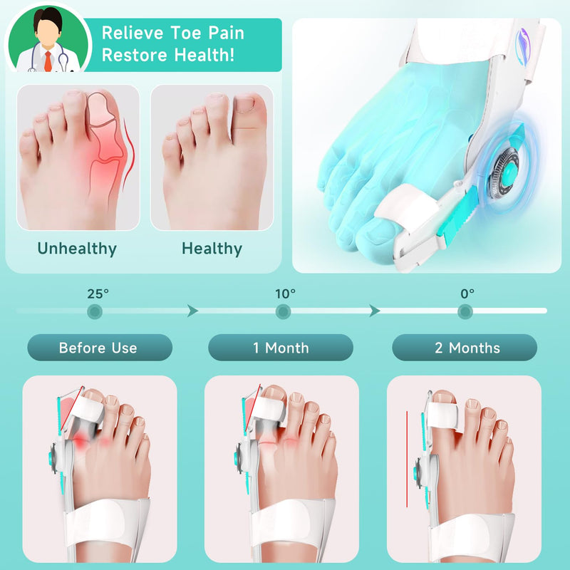 Bunion Corrector for Women & Men - Bunion Fix for Hallux Valgus Pain Relief with Non-Slip Big Toe Separator, Adjustable Big Toe Straighter, Bunion Splints Fits Left & Right Feet (White 1Pcs) White 1
