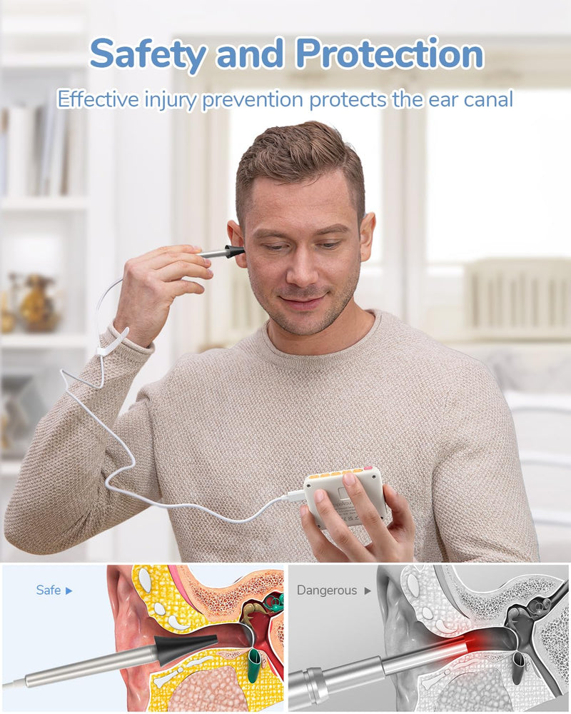 Ear Specula Set for ScopeAround Digital Otoscope, Set of 50 Pieces, Replacement Otoscope Tips, Ear Speculum, Compatible with ScopeAround SA39W/SA39i/M28/MS450 Otoscope - BeesActive Australia
