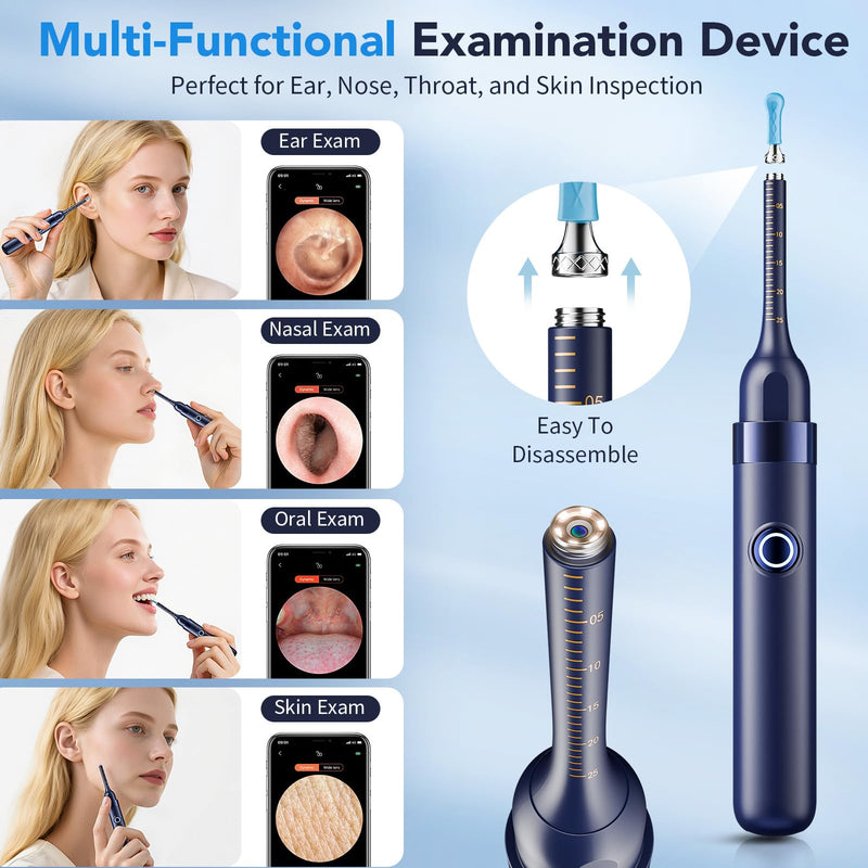 Ear Wax Removal, Ear Cleaner with Camera 1296P HD,Visual Ear Cleaner with 6 LED Lights and Flexible Tip,FSA HSA Eligible Items,Safe Ear Wax Removal Kit with Camera,Ear Cleaning Tool for Family Gifts Black - BeesActive Australia