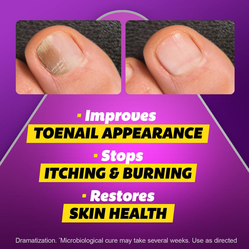 SILKA Max Strength Antifungal Liquid for Toenail Health with Brush Applicator, Results in 1 Week, Nail Fungus Treatment for Damaged Toenails, Athlete's Foot Treatment, Tolnaftate 1% 0.45 Fl Oz 0.45 Ounce (Pack of 1) - BeesActive Australia