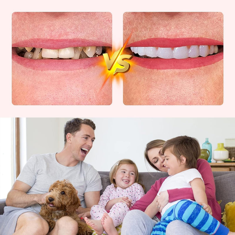 8 Set Fake Teeth Natural White Artificial Teeth, Comfort-fit and Life-Like Teeth for Male and Female, Rediscover Your Confident Grin with Elegance,veneers Teeth for Women (8) 8 - BeesActive Australia