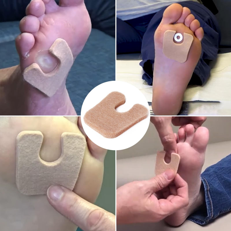 MoyRetty 60pcs U-Shaped Felt Callus Pads, Metatarsal Pads Self-Stick Cushions Protect Calluses from Rubbing on Shoes, Reduce Foot and Heel Pain