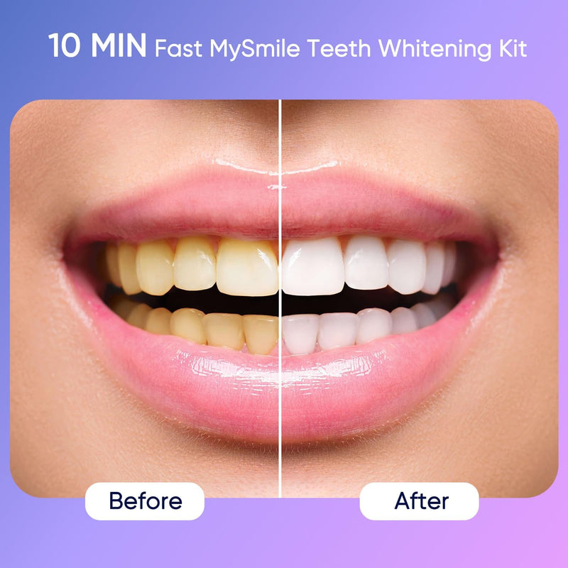 MySmile Deluxe 10 Min Teeth Whitening Kit with 28 LED Light, 35% Carbamide Peroxide Teeth Whitening Gel, Helps Remove Years of Stains from Coffee, Soda, Wines, Smoking, Food 10 Fl Oz (Pack of 1) - BeesActive Australia