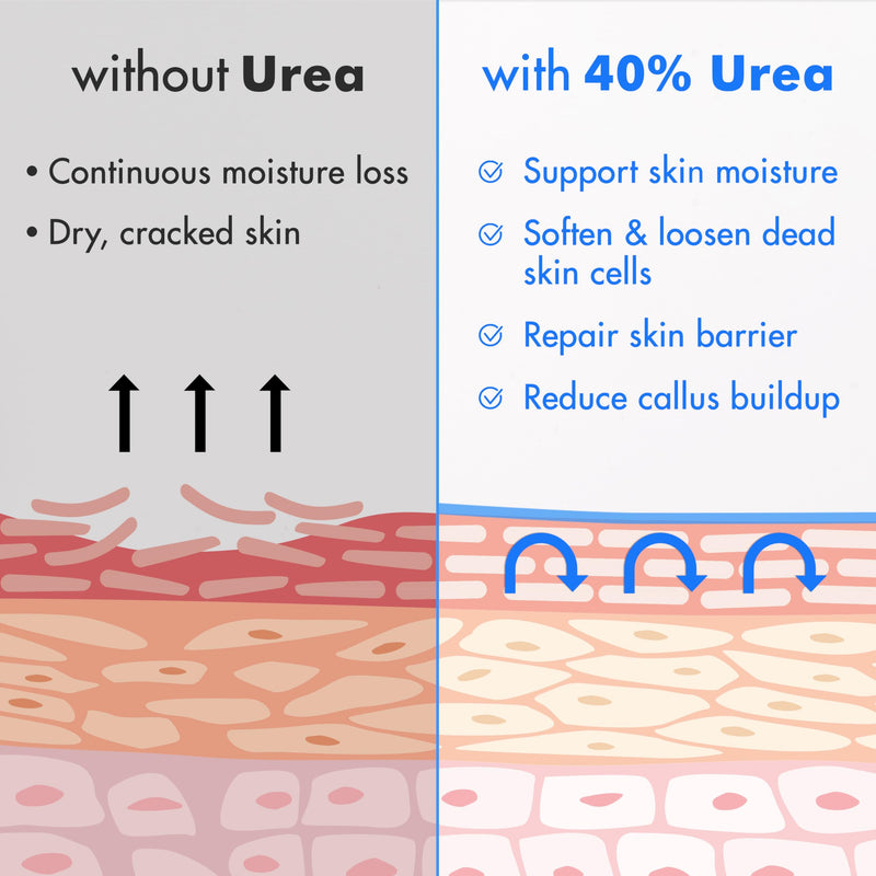 Ebanel Urea Cream 40% plus Salicylic Acid 2%, Foot Cream for Dry Cracked Heels Feet Knees Elbows Hands, Foot Dead Skin Cuticle Callus Remover Toenail Softener, Keratolytic Skin Barrier Repair 4.6 Ounce (Pack of 1) - BeesActive Australia