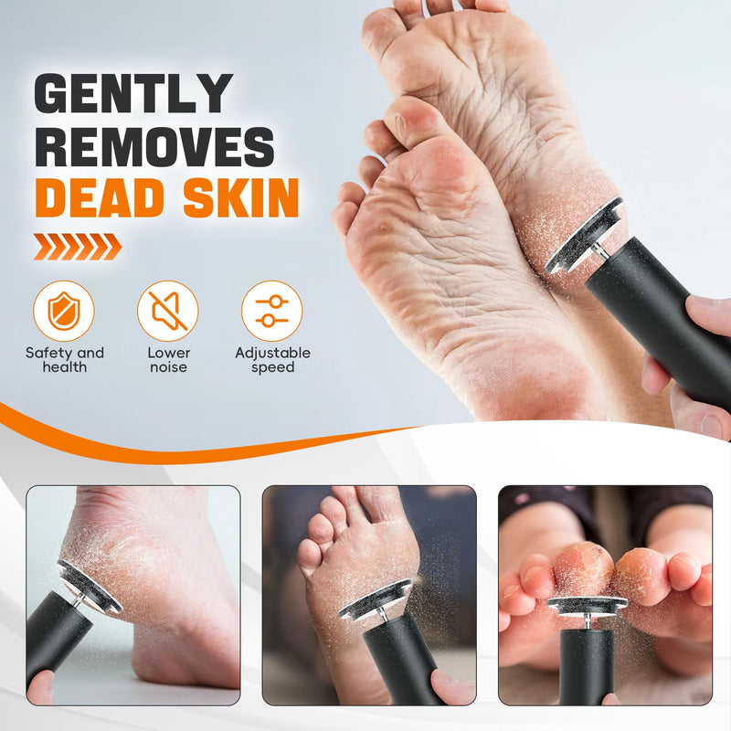 Electric Foot Callus Remover,Electric Foot File Speed Adjustment & Direction of Rotation Controller, Pedicure Tools for Feet with 60Pcs Replacement Sandpaper,for Men Women Dead Skin and Calluses - BeesActive Australia