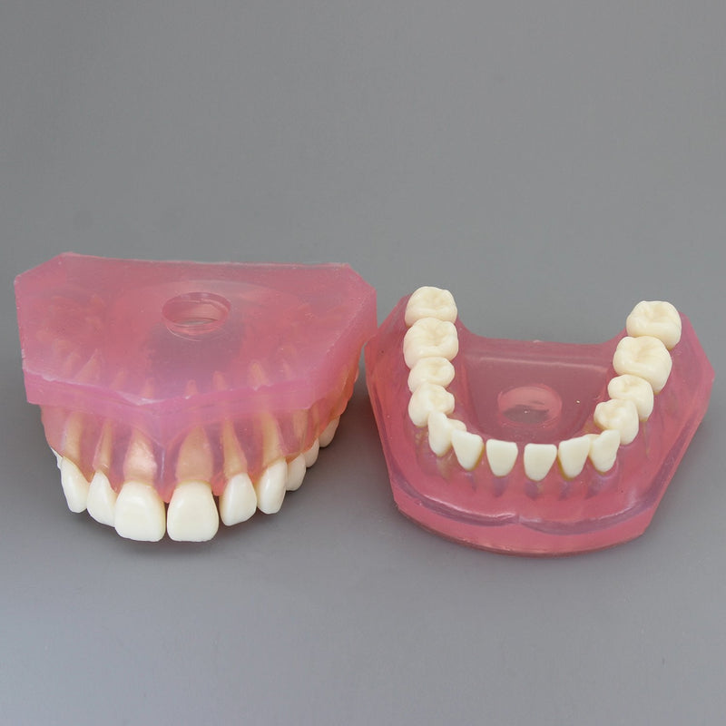 Dental Implant Teeth Model with Removable Teeth for Dental Professionals and Students - BeesActive Australia