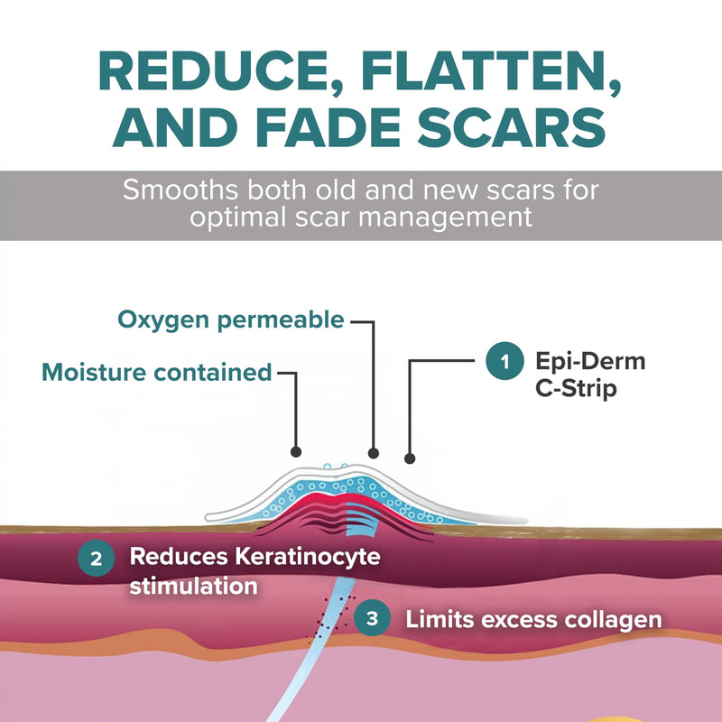 Epiderm Silicone Gel Scar Sheets - Premium-Grade Silicone Scar Sheets for Optimal Scar Care - Versatile, Flexible & Reusable - Ideal for C-Section, Tummy Tuck & Hysterectomy Scars - 1.4x6 in, Natural 1.4x6 Inch (Pack of 1) - BeesActive Australia