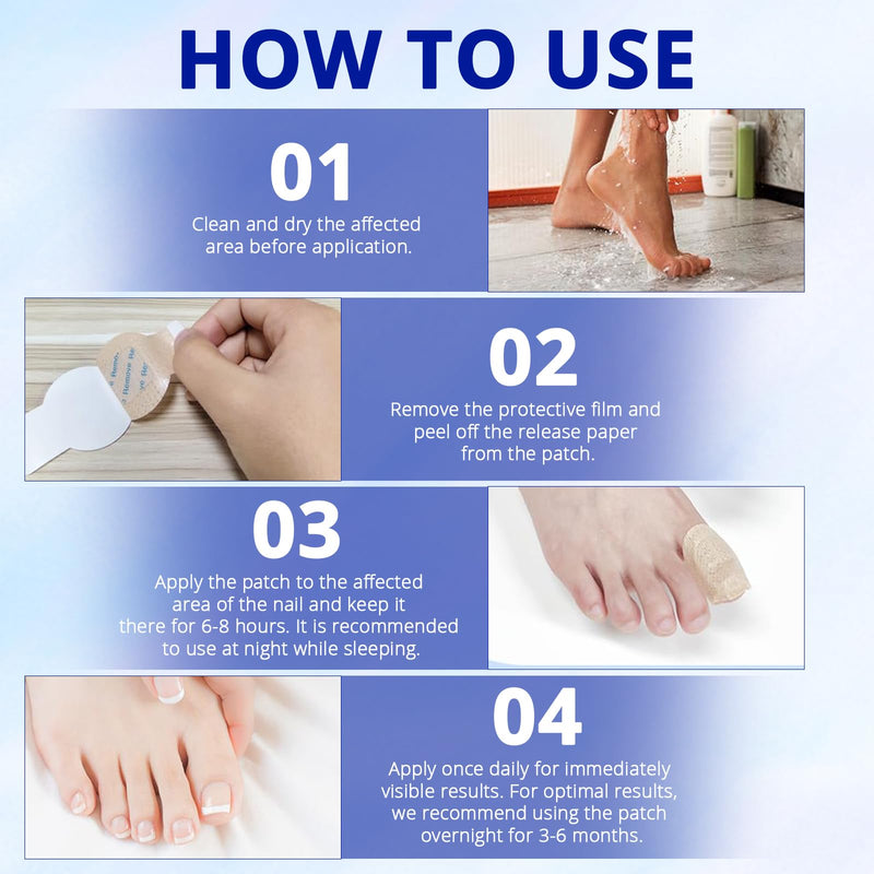 Fungal Nail Patches-Toenail Fungus Treatment Extra Strength, Toe Nail Fungus Treatments, Overnight Hydrogel Nail Care Patches, Nail Repair, Easy To Apply, 42Pcs, For Men & Women,HUIzhijia2pack - BeesActive Australia