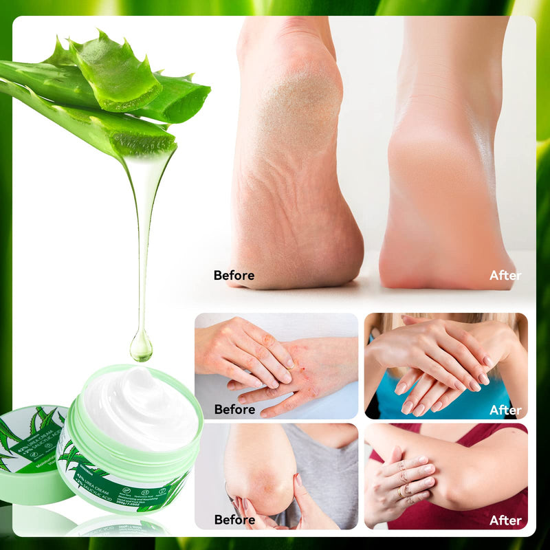Urea Cream 42 Percent for Feet 7.0 Oz, 2% Salicylic Acid, Aloe Vera, Hyaluronic Acid , Deeply Moisturize Skin Cream For Dry Cracked Feet, Hands, Heels, Elbows, Nails, Knees, Intensive Moisturizes & - BeesActive Australia