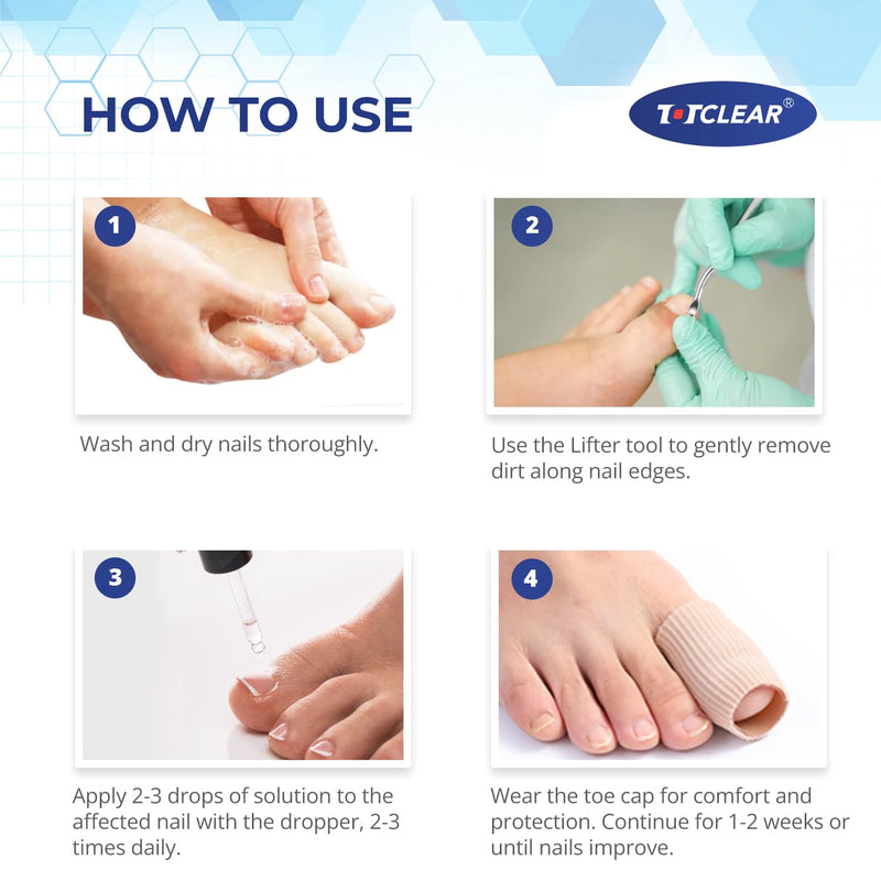 Ingrown Toenail Relief: Ingrown Toenail Tool for Men Women - Ingrown Toenail Removal Kit - Ingrown Toenail Corrector Drops - Ingrown Toenail Removal - Effective Solution for Ingrown Toenails - 30ml 1 Fl Oz (Pack of 1)