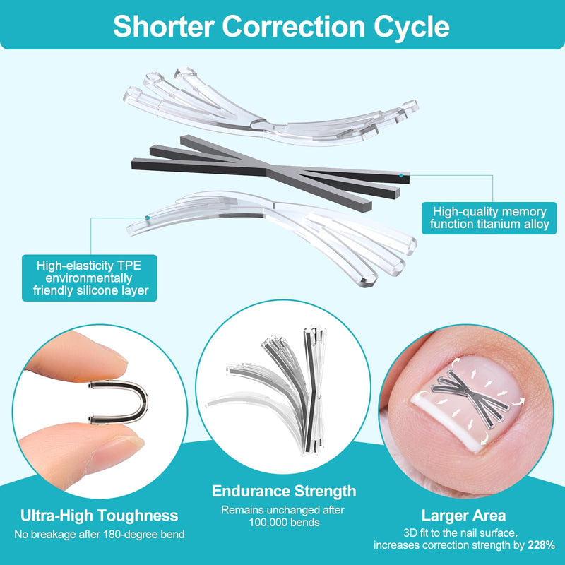 Ingrown Toenail Treatment Kit with Upgraded 6-Angle Shape,Titanium Alloy Ingrown Nail Corrector Tools with 4 Multi-Sizes,Ingrown Toe Nail Relief Remover Strips for Curved Toenail Quick Relief,8Pcs - BeesActive Australia