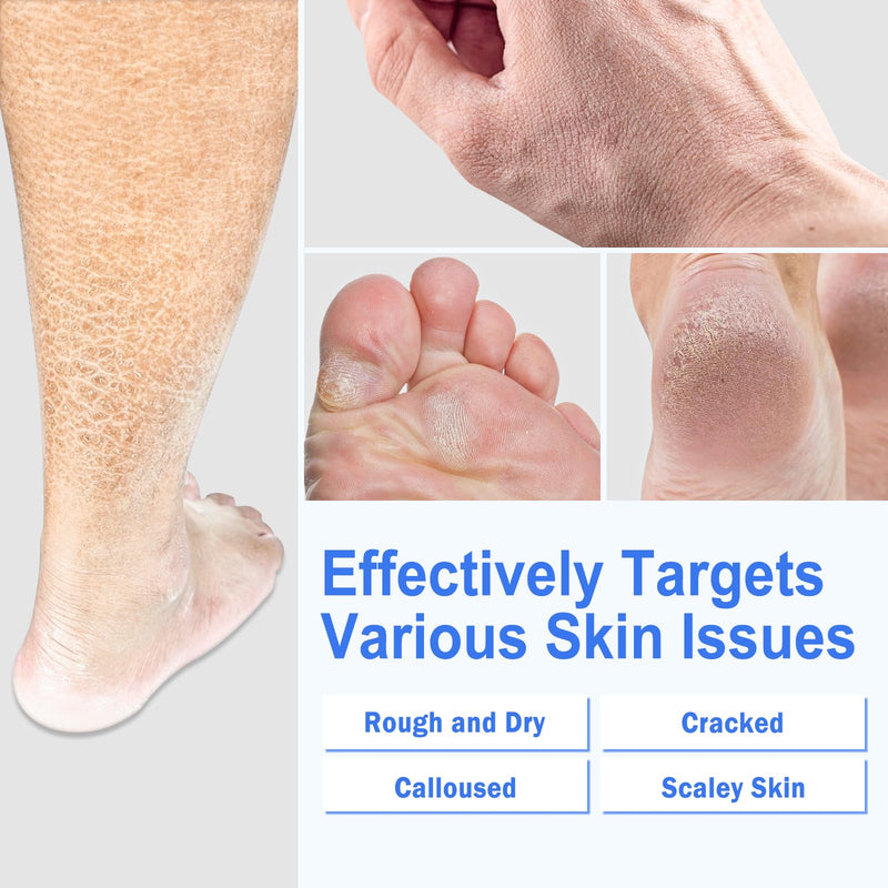 TEAWOO Ultra-Hydrating Urea Cream (Urea Conc. 40.67%), Foot Cream for Dry Cracked Heels and Feet, Pair with Moisturizing Heel Socks for Cracked Heel Treatment, Heel Socks Included (5.29 OZ/150g) Bundle - Foot Cream + Heel Socks - BeesActive Australia